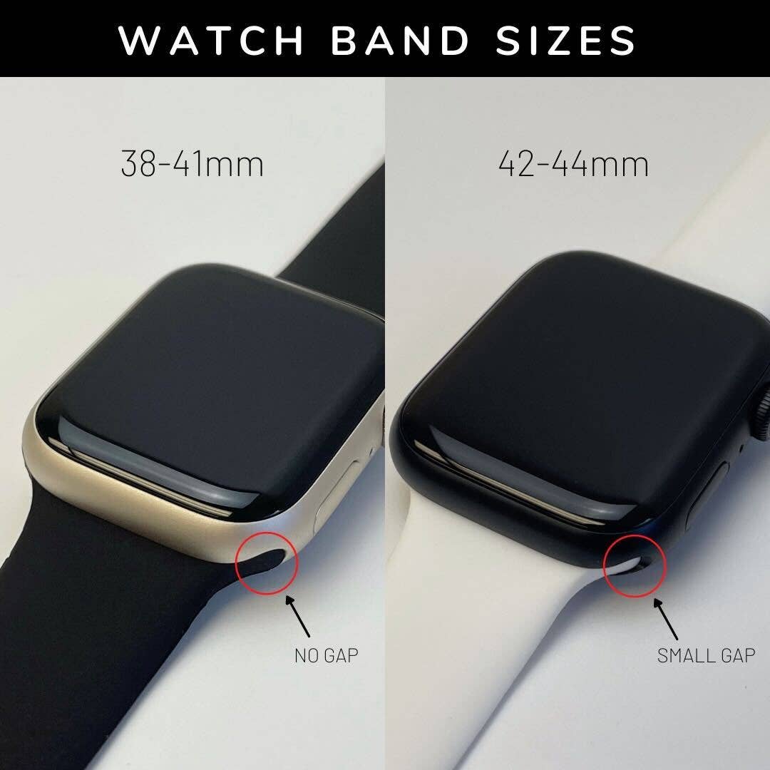 Mystery Apple Watch Band lol